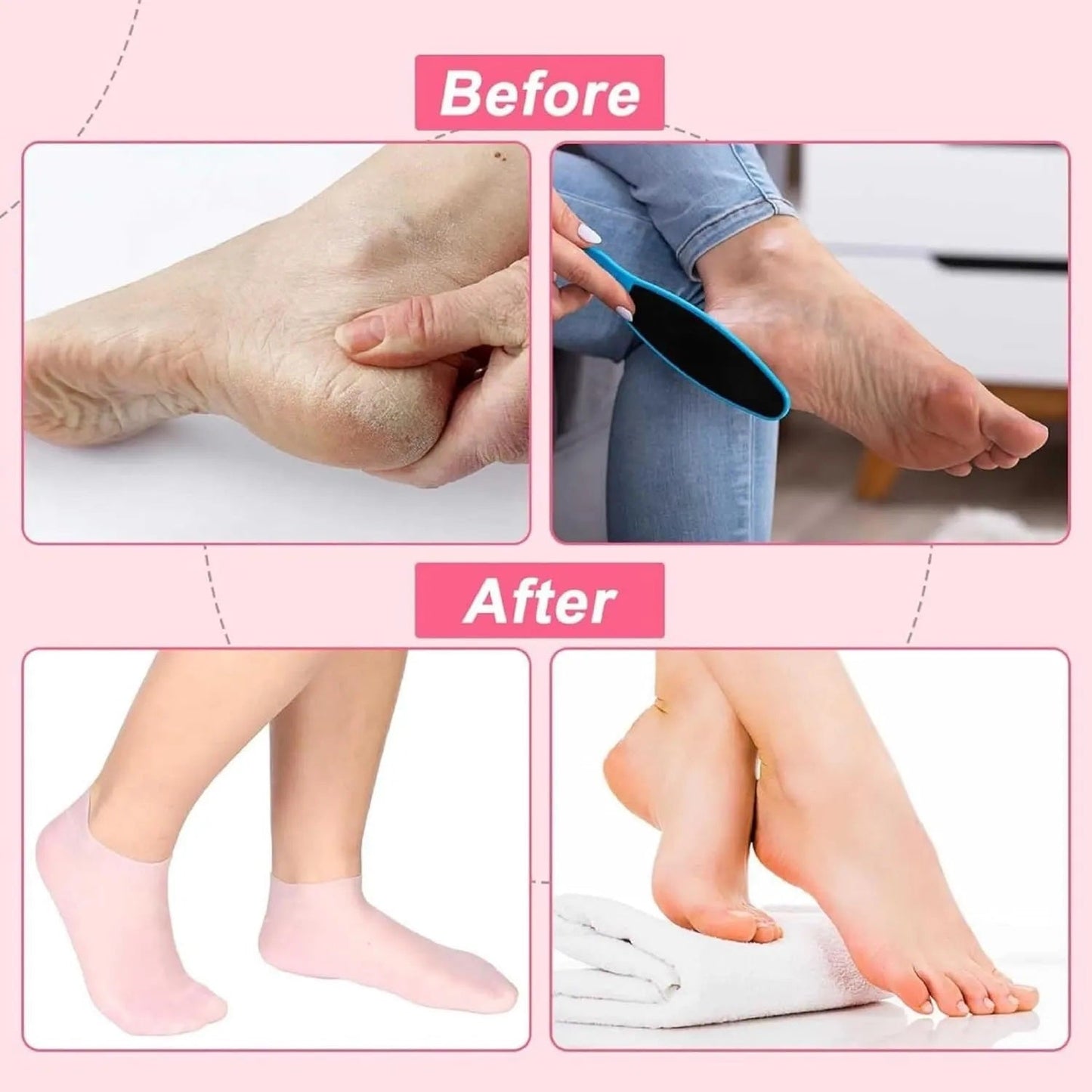 SILICONE  MOISTURIZING SOCKS